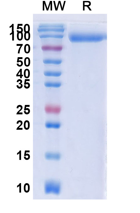 SDS-PAGE for CD6 recombinant protein