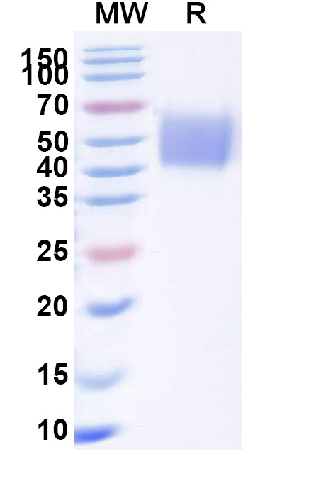 SDS-PAGE for CD66c Recombinant Protein