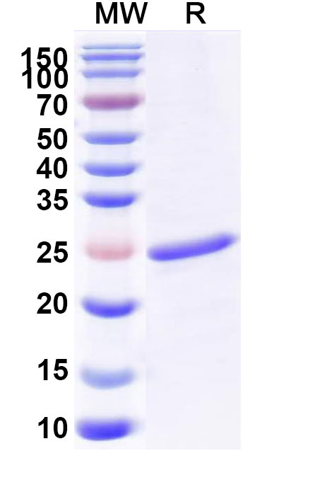 SDS-PAGE for CLCF1, N-His, recombinant protein