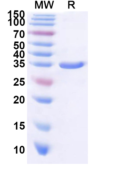 SDS-PAGE for CP, N-His, recombinant protein