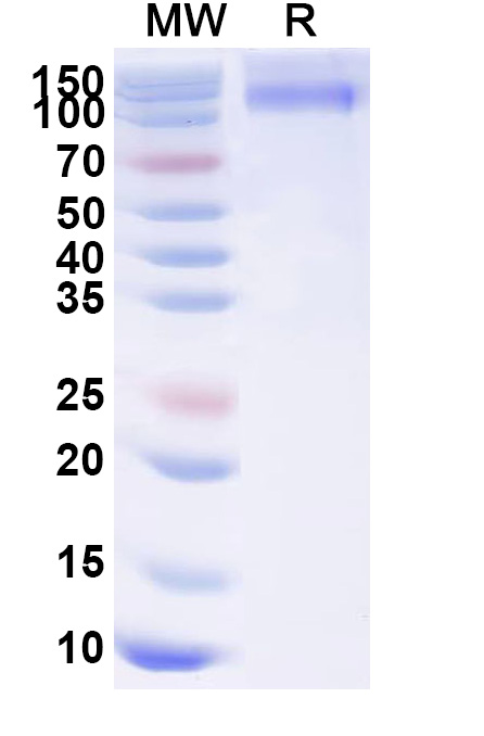 SDS-PAGE for Dog CD117 recombinant protein