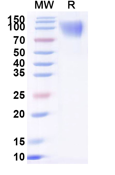SDS-PAGE for Dog CD117 recombinant protein
