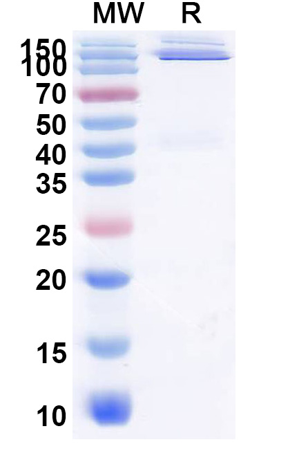SDS-PAGE for Research Grade Donzakimig