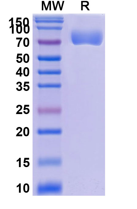 SDS-PAGE for Research Grade Efaprinermin Alfa