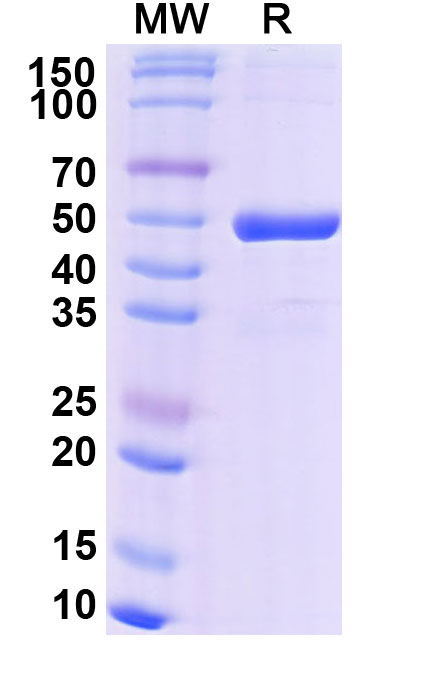 SDS-PAGE for Research Grade Efgivanermin Alfa