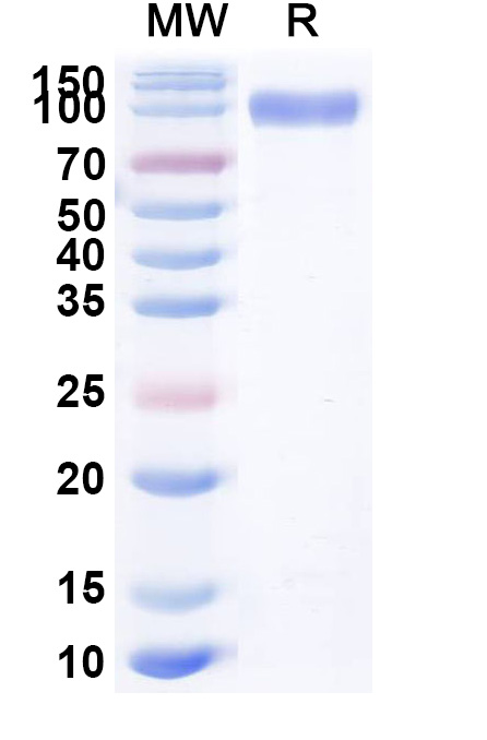 SDS-PAGE for EGFR / ERBB1 / HER1, C-His, recombinant protein