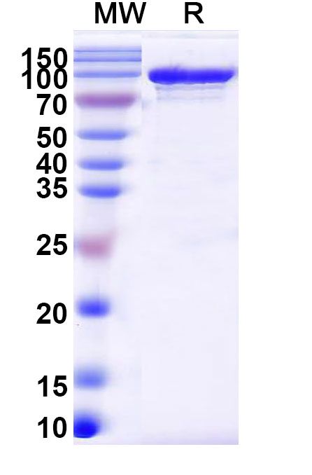 SDS-PAGE for Endo S2/Endo-beta-N-acetylglucosaminidase