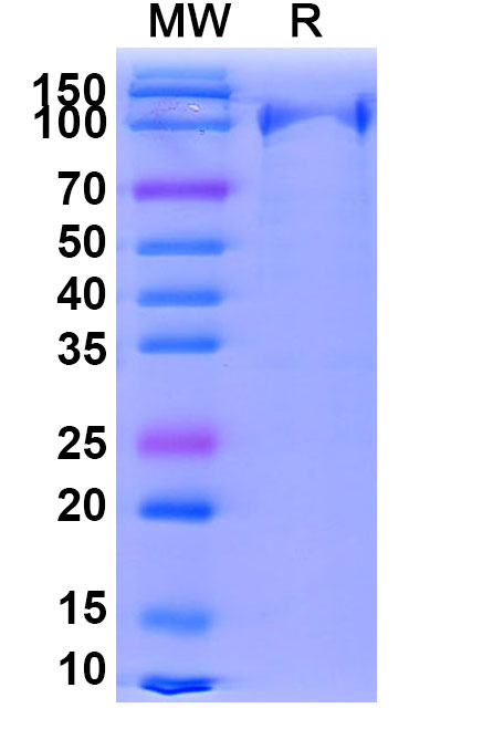 SDS-PAGE for EndoS