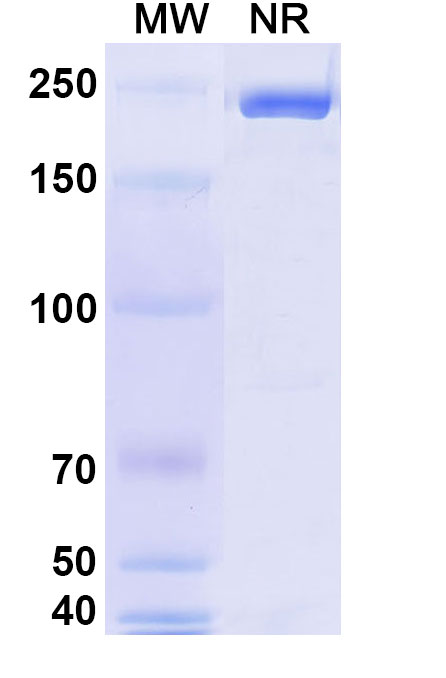 SDS-PAGE for Research Grade Erzotabart