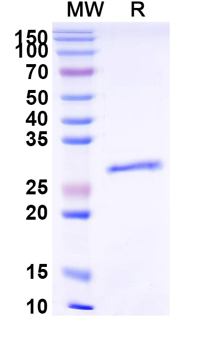 SDS-PAGE for Estrogen receptor (in E.coli)