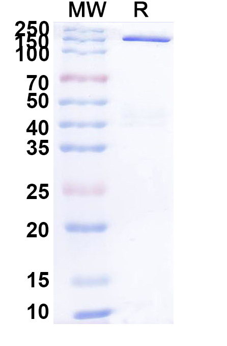 SDS-PAGE for Research Grade Galvokimig