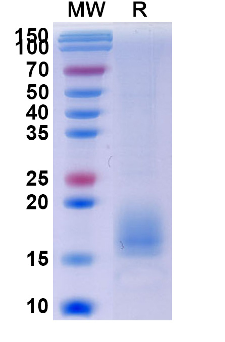 SDS-PAGE for Human ACVR1B recombinant protein