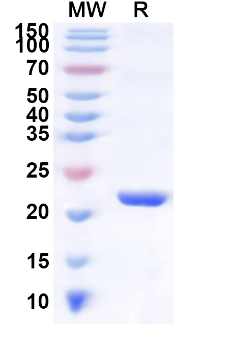 SDS-PAGE for Human ANKS6 Recombinant Protein, N-His
