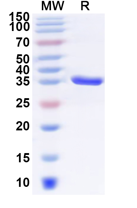 SDS-PAGE for Human APH1A Recombinant Protein, N-GST & C-His