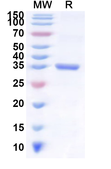SDS-PAGE for Human ARID2 Recombinant Protein, N-His