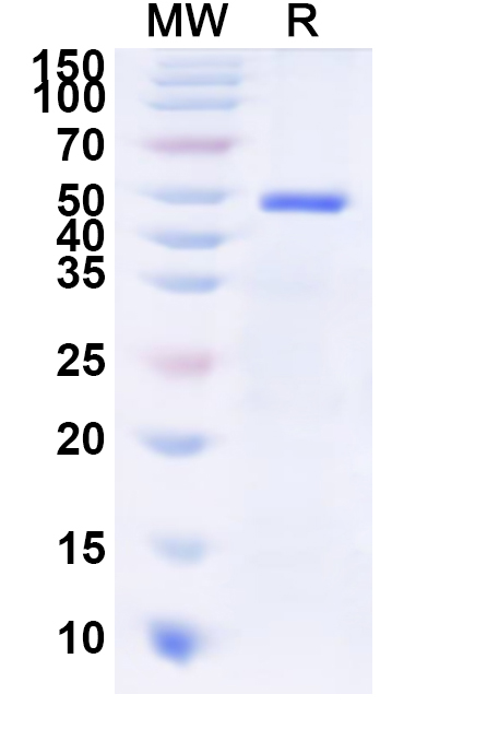 SDS-PAGE for Human B4GALNT1 Recombinant Protein, N-His