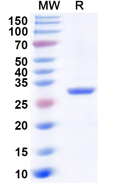 SDS-PAGE for Human CA5A Recombinant Protein, N-His