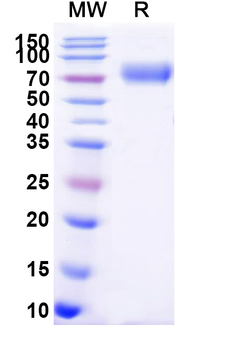 SDS-PAGE for Human CD102/ICAM2 Recombinant Protein, C-Fc