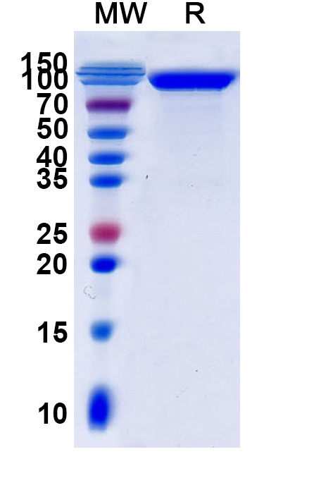 SDS-PAGE for Human CD108-SEMA7A recombinant protein