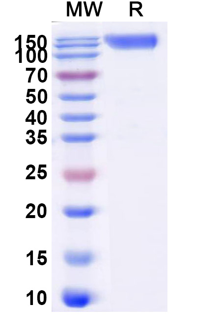 SDS-PAGE for Human CD115/CSF1R Recombinant Protein, C-Fc