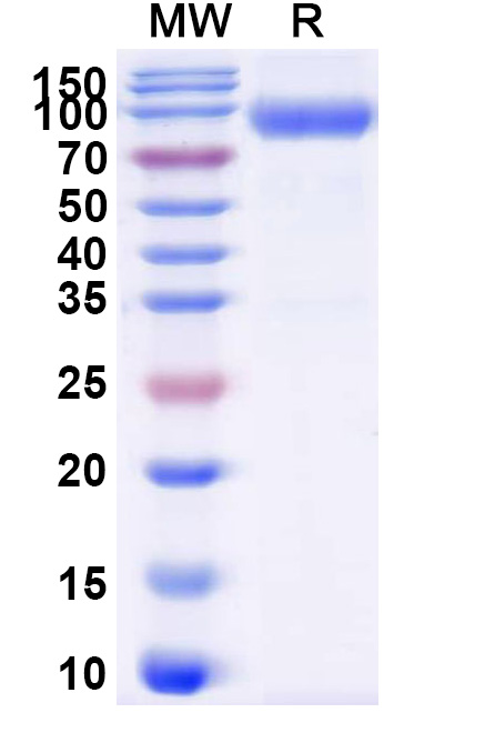 SDS-PAGE for Human CD116/CSF2RA Recombinant Protein, C-Fc