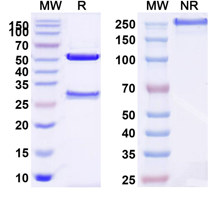 SDS-PAGE for Human CD117/KIT Monoclonal Antibody