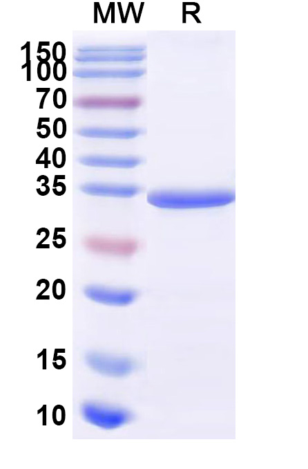 SDS-PAGE for Human CD117/KIT Recombinant Protein, C-Fc