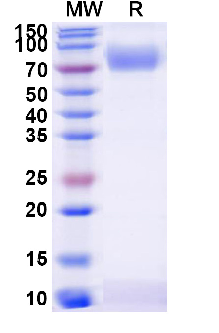 SDS-PAGE for Human CD119/IFNGR1 Recombinant Protein, C-Fc