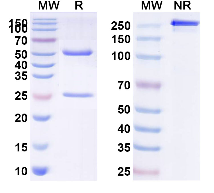 SDS-PAGE for Human CD143/ACE Monoclonal Antibody