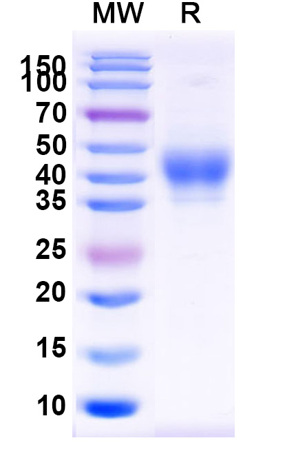 SDS-PAGE for Human CD158b1 recombinant protein