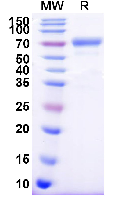 SDS-PAGE for Human CD158b1 recombinant protein