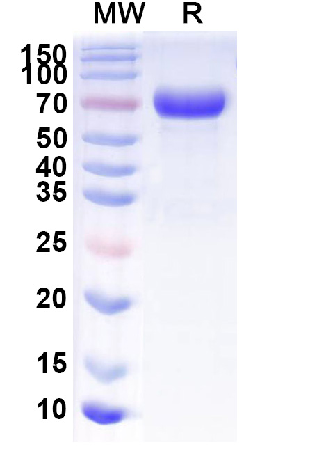SDS-PAGE for Human CD158h recombinant protein