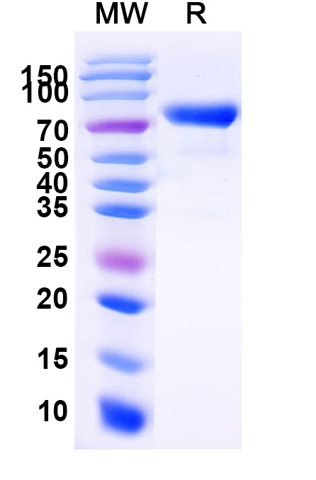 SDS-PAGE for Human CD158i/KIR2DS4 Recombinant Protein, C-Fc