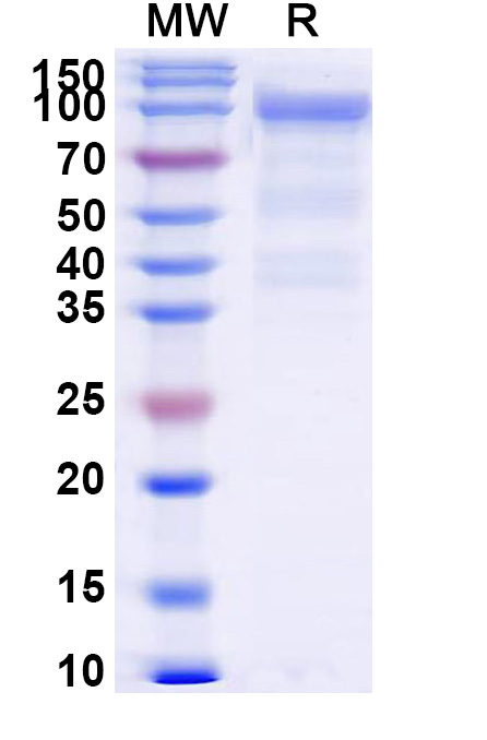 SDS-PAGE for Human CD162 recombinant protein