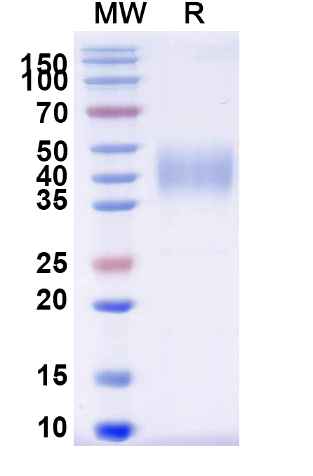 SDS-PAGE for Human CD16b-FCGR3B recombinant protein