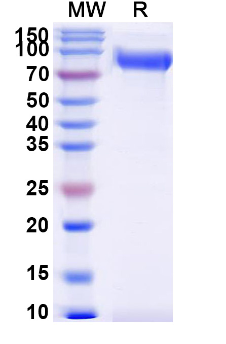 SDS-PAGE for Human CD172a/SIRPA Recombinant Protein, C-Fc