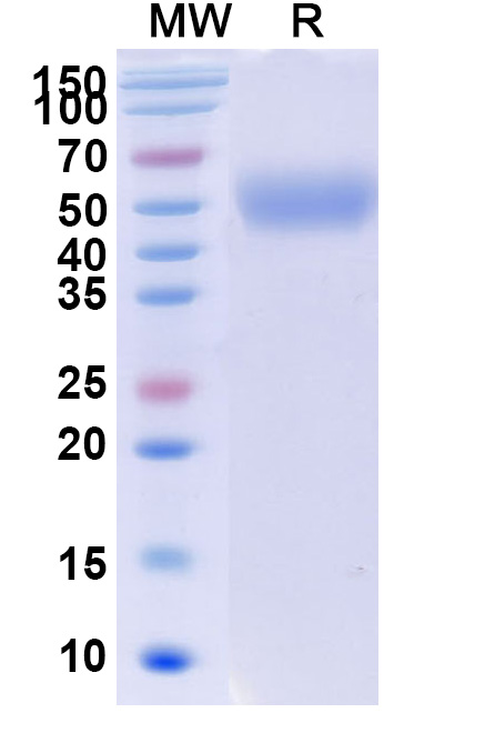SDS-PAGE for Human CD172b-SIRPB1 recombinant protein