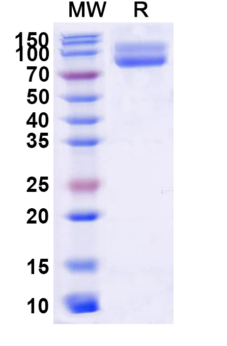 SDS-PAGE for Human CD172g/SIRPG Recombinant Protein, C-Fc