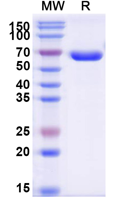 SDS-PAGE for Human CD2/LFA-2 Recombinant Protein, C-Fc