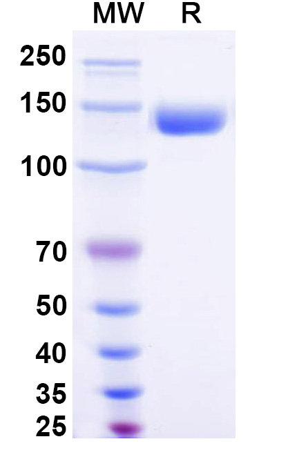 SDS-PAGE for Human CD202b/TEK Recombinant Protein, C-Fc