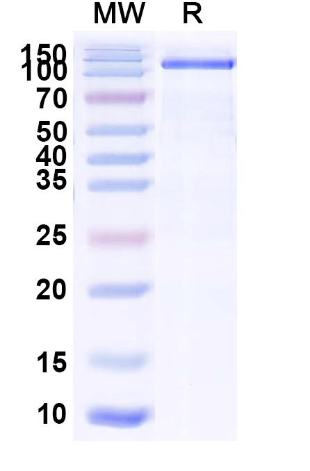 SDS-PAGE for Human CD21/CR2 Recombinant Protein, C-His