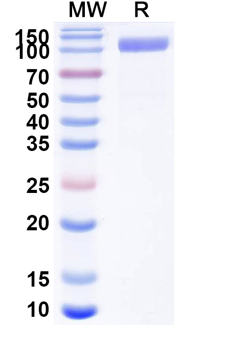 SDS-PAGE for Human CD22 recombinant protein