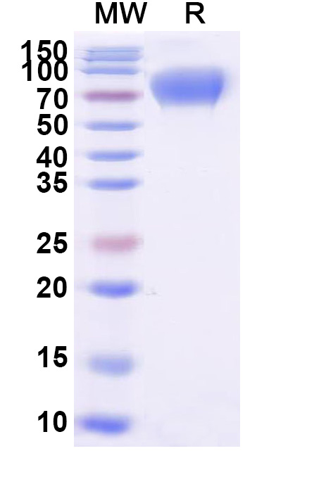 SDS-PAGE for Human CD226/DNAM-1 Recombinant Protein, C-Fc