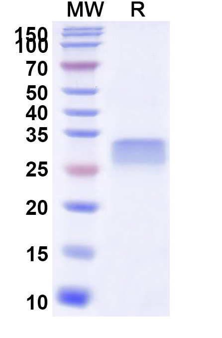SDS-PAGE for Human CD26/DPP4 Recombinant Protein, N-His