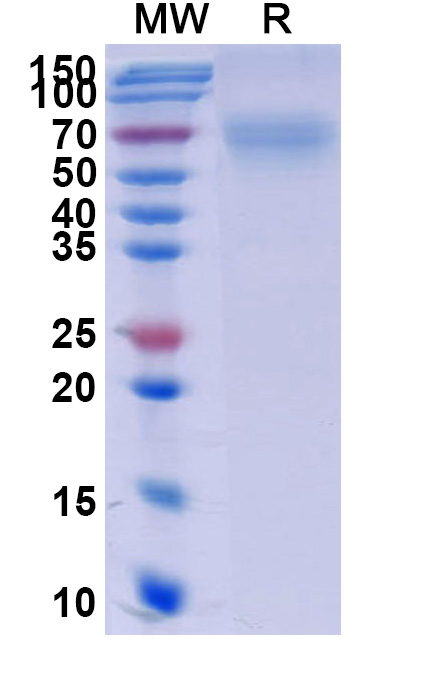SDS-PAGE for Human CD264-TNFRSF10D recombinant protein
