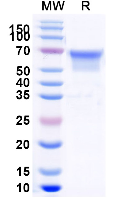 SDS-PAGE for Human CD27 Recombinant Protein, C-Fc