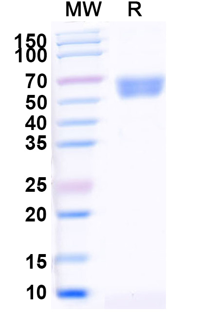 SDS-PAGE for Human CD292/BMPR1A Recombinant Protein, C-Fc