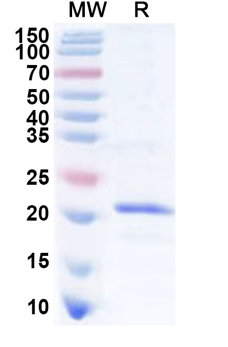 SDS-PAGE for Human CD300A Recombinant Protein, N-His