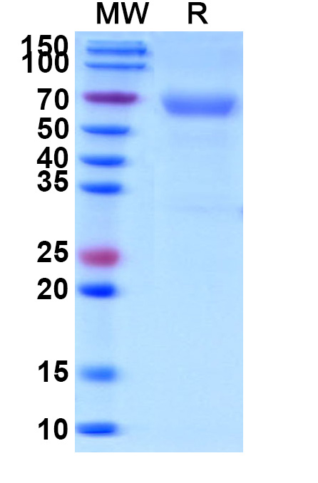 SDS-PAGE for Human CD320 recombinant protein