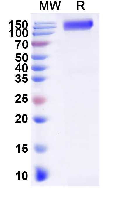 SDS-PAGE for Human CD332/FGFR2 Recombinant Protein, C-Fc